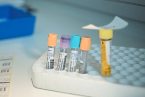 Blood and urine tests