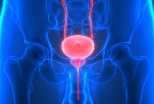 Bladder conditions