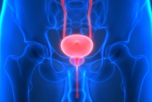 Bladder conditions